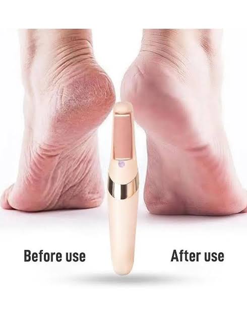 WEIMEI Electronic Pedicure Tool – Rechargeable Electric Foot File Callus Remover with Dual Speed & 2 Replacement Roller Heads
